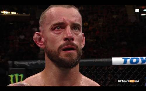 La cara de CM Punk tras su derrota ante Mickey Gall en UFC 203