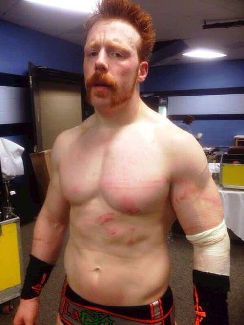 Sheamus luego de su lucha estilo Memphis