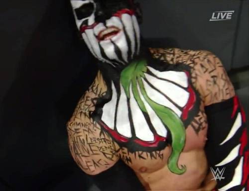 El hombro derecho de Finn Bálor salido tras un ataque de Seth Rollins en WWE SummerSlam 2016 - WWE