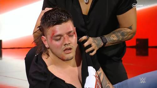 Dominik Mysterio fue brutalizado por Rhea Ripley (08/08/2022) / WWE