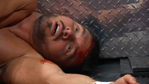 Superluchas - Un luchador tirado en el suelo con sangre en la cara durante un combate de WWE SMACKDOWN.